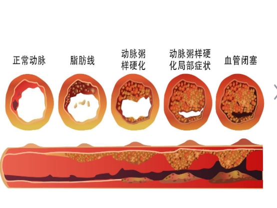 除了治疗功能障碍，西地那非还有4种作用，多点了解没坏处