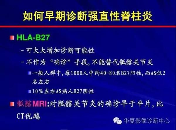 七十年代怎样治疗强直性脊柱炎