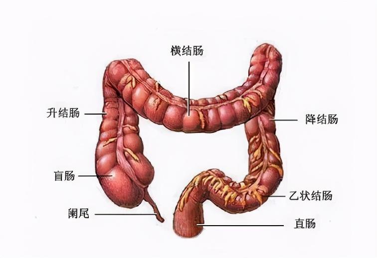 溃疡性结肠炎引发毛囊炎