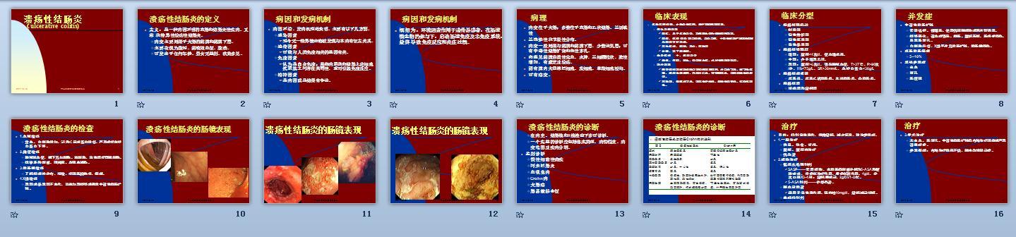 溃疡性结肠炎分型