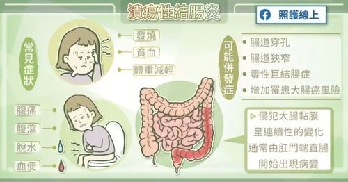 溃疡性结肠炎中医辨证