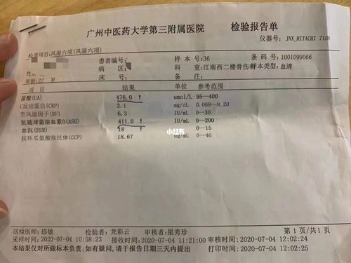 查哪些指标能够确诊强直性脊柱炎