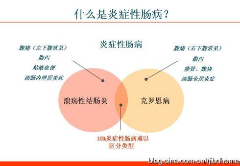 溃疡性结肠炎分型标准