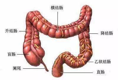 结肠癌都是溃疡性结肠炎导致的吗