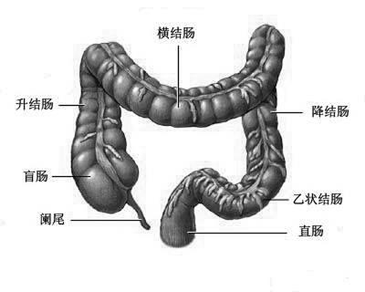 西安慢性非特异性溃疡性结肠炎