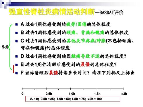 强直性脊柱炎指南