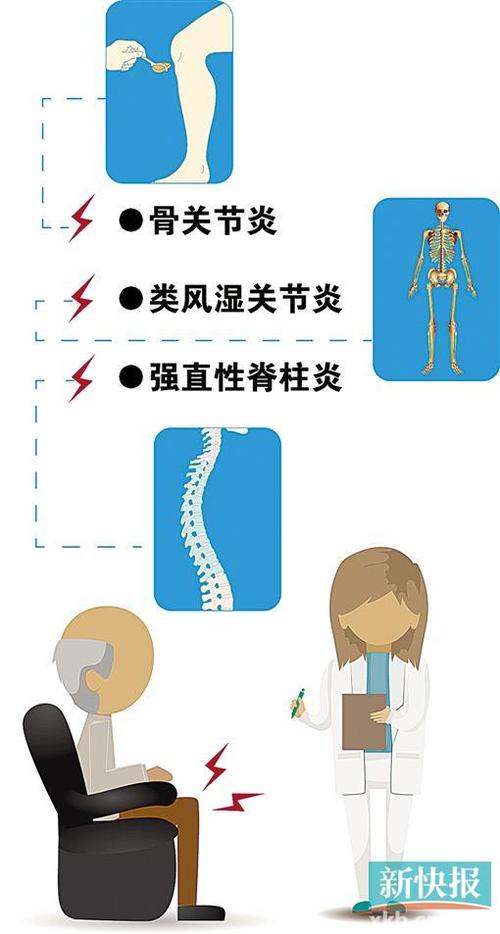 骶骨关节炎到强直性脊柱炎症状