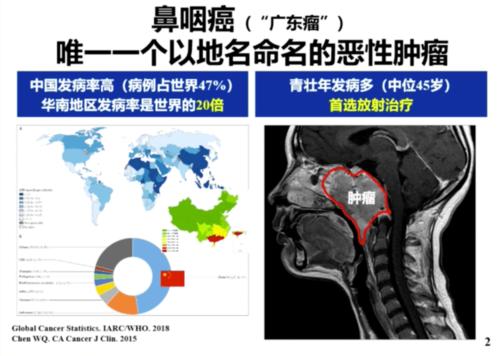 鼻咽癌