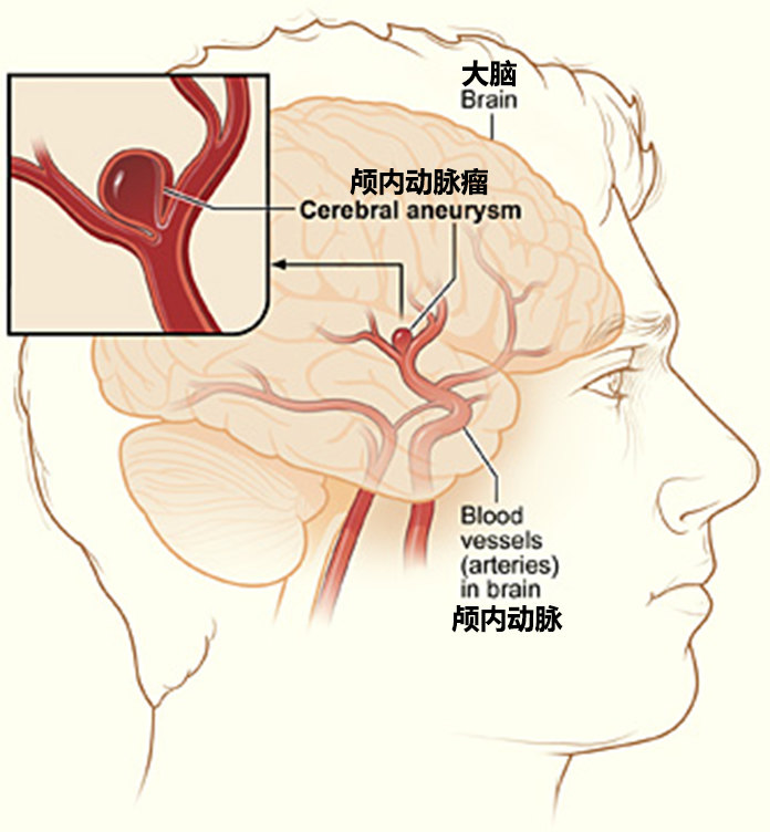 贝伐珠单抗不良反应_贝伐珠单抗4个月后赠药_肺癌贝伐珠单抗用药5只