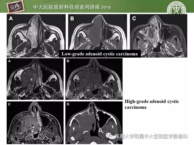 贝伐球单抗是靶向药吗_贝伐单抗多少钱拿赠药_贝伐单抗赠药条件