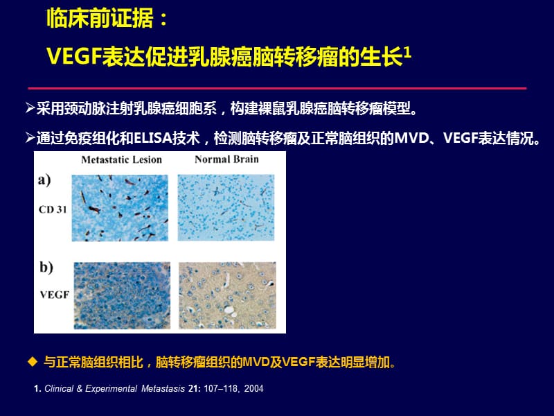 贝伐珠单抗治疗肺腺癌_贝伐珠单抗溶解到100ml_贝伐珠单抗价格