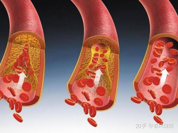 贝伐单抗和贝伐珠单抗_贝伐珠单抗是化疗药吗_肺腺癌早期可以用贝伐珠单抗