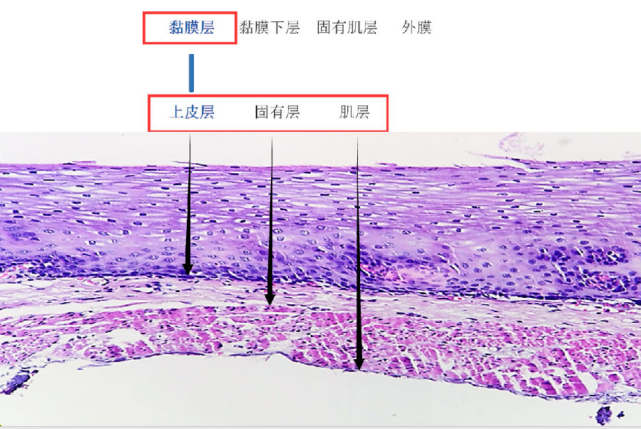 贝伐珠单抗注射液_贝伐珠单抗治疗肺腺癌_贝伐珠单抗化疗后久可手术