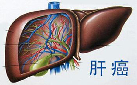 贝伐珠单抗注射液_贝伐珠单抗化疗后久可手术_贝伐珠单抗赠药