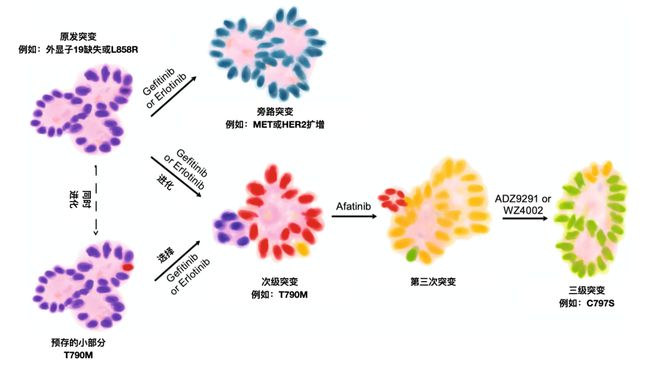 肺癌盲试靶向药奥希替尼_肺癌肝转移 靶向药_肺癌骨转移吃靶向药