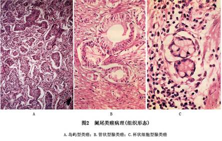 贝伐珠单抗用多久后可以手术_贝伐珠单抗注射液_贝伐珠单抗报销后价格