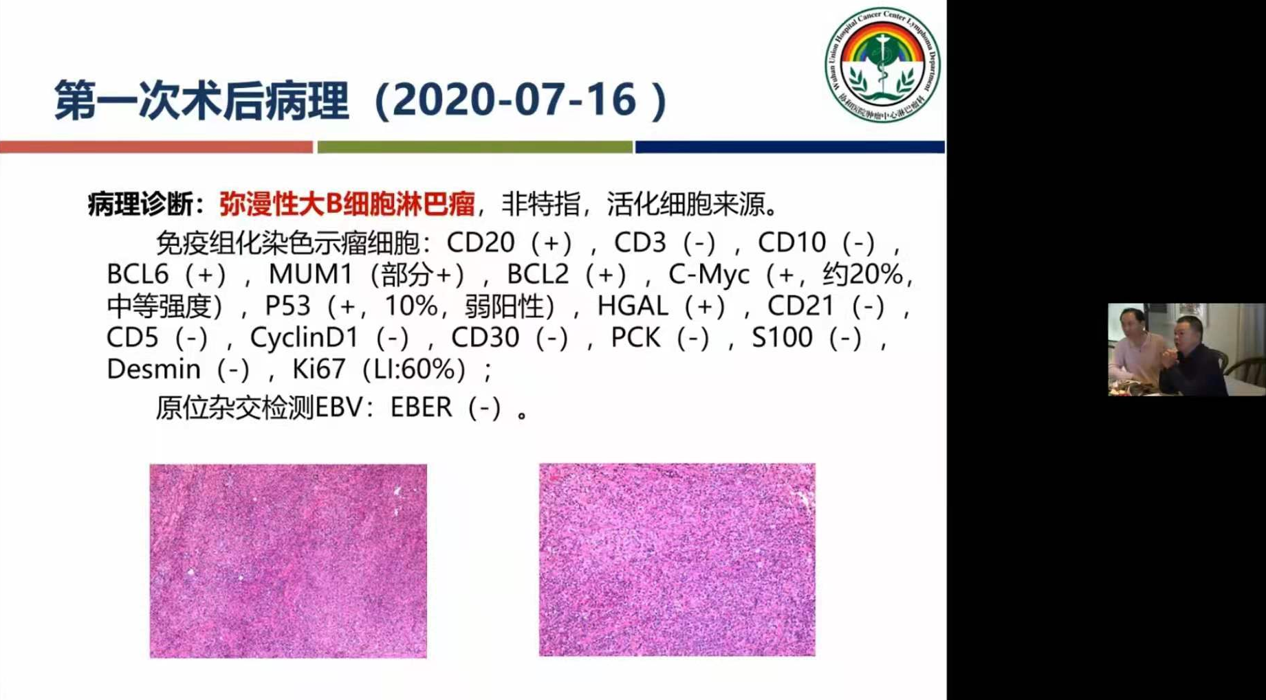 贝伐珠单抗价格_贝伐珠单抗能不能用于肉瘤_贝伐珠单抗赠药