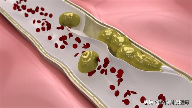 贝伐珠单抗 耐药性_贝伐珠单抗是靶向药吗_贝伐珠单抗如何生产