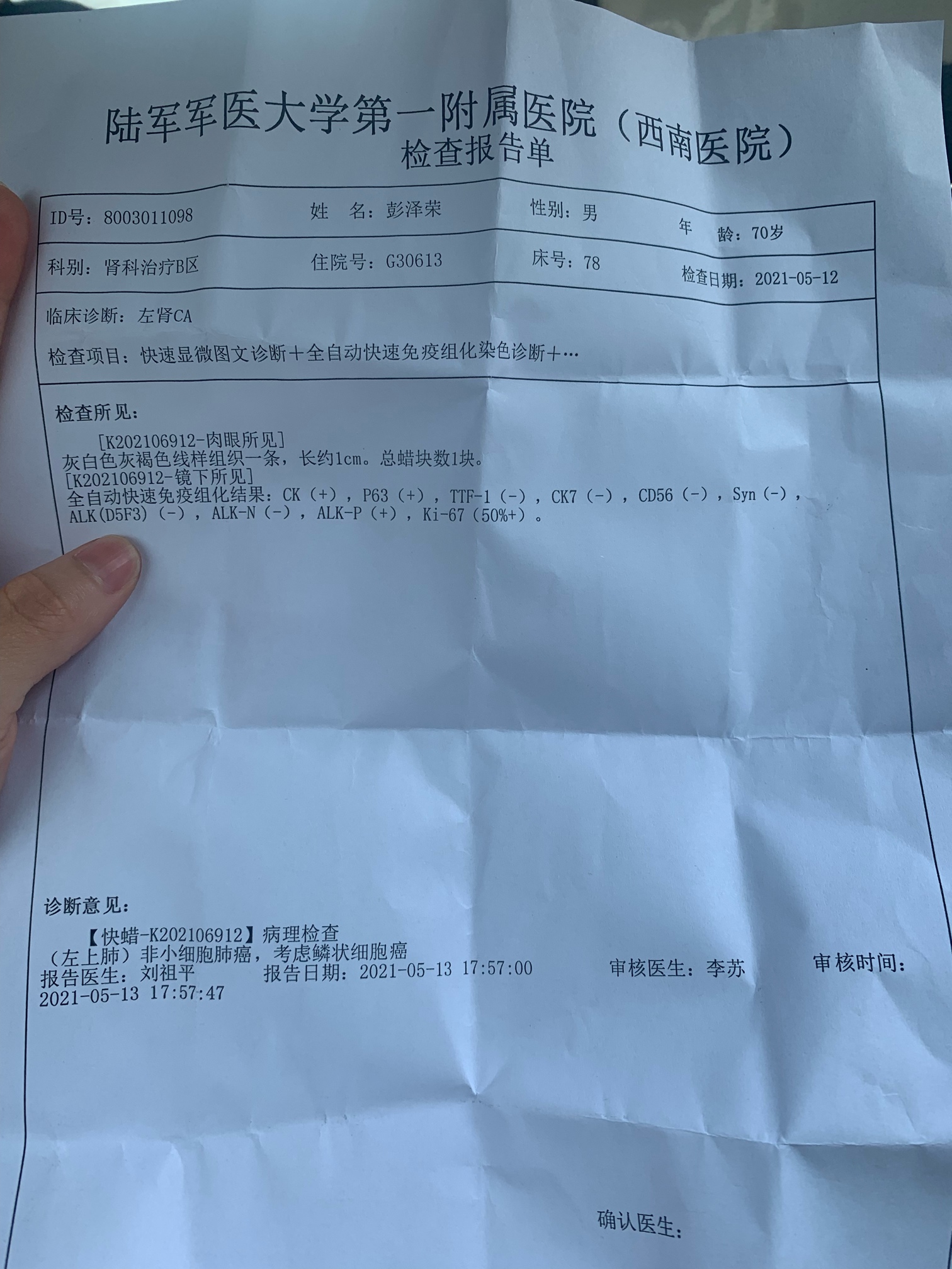 贝伐珠单抗在河北报销_贝伐珠单抗_结肠癌晚期 贝伐珠单抗