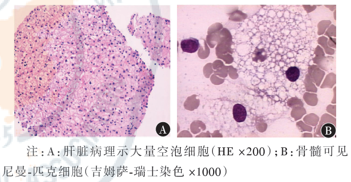 索拉非尼价格_索拉非尼有印度_用量减半索拉非尼有效果吗