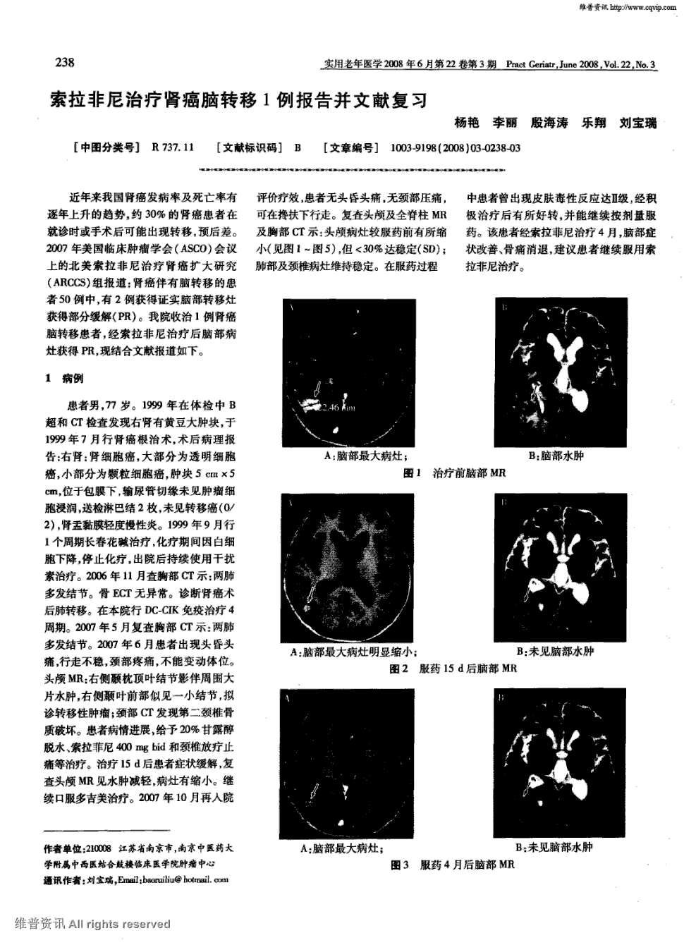 奥斯替尼和奥希替尼_奥希替尼印度版多少钱_奥希替尼研究