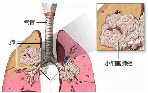 患者服用阿帕替尼评价_家教之抑郁症患者纲吉_吉非替尼适合什么患者