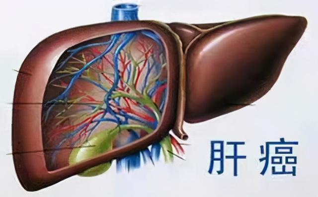 贝伐珠单抗治疗肺腺癌_贝伐珠单抗价格_贝伐珠单抗延长生命