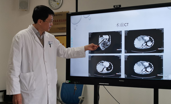 肠癌用贝伐单抗可以报销吗_贝伐珠单抗多少钱一支_贝伐珠单抗价格