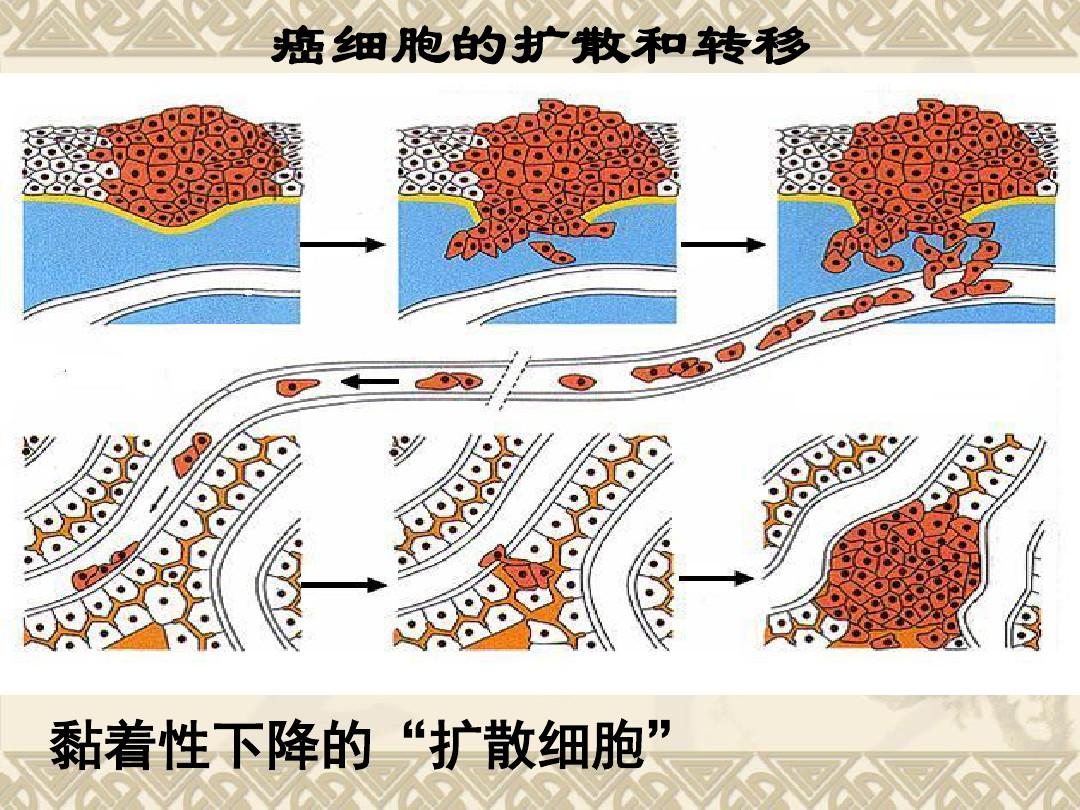 贝伐珠单抗注射液_贝伐珠单抗适合小细胞肺癌吗_贝伐珠单抗4个月后赠药