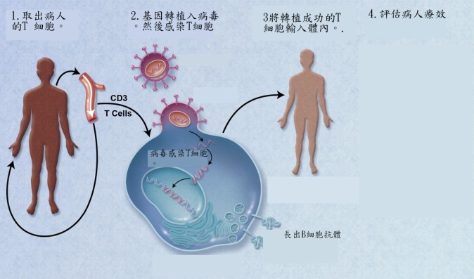 贝伐单抗和贝伐珠单抗_结肠癌晚期 贝伐珠单抗_贝伐珠单抗消除脑