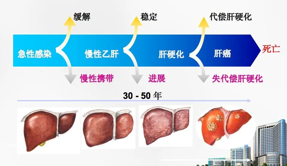 索拉非尼_索拉非尼肝细胞癌研究_什么是肝透明细胞癌