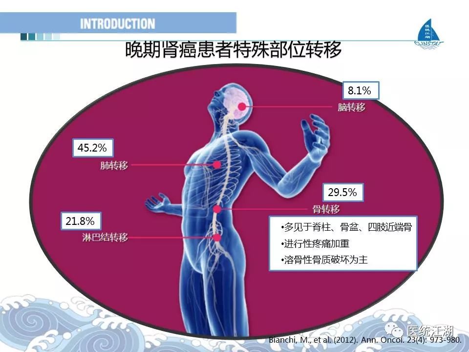 奥妮克希亚龙缰绳掉率_印度9291奥希替尼图片_奥希替尼入脑率