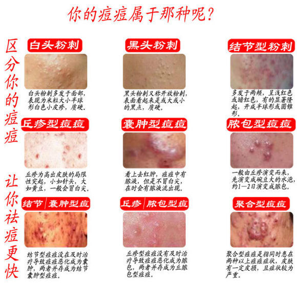 吉非替尼首仿_新药证书 首仿_印度仿制的芦可替尼