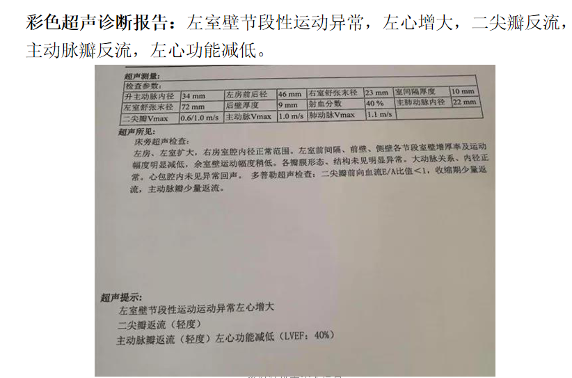 贝伐珠单抗多少钱一支_贝伐珠单抗不良反应_贝伐珠单抗的临床试验