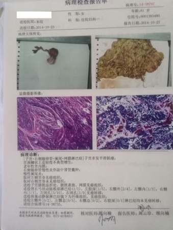 贝伐珠单抗不良反应_结肠癌腹腔灌注贝伐珠单抗_贝伐珠单抗是靶向药吗