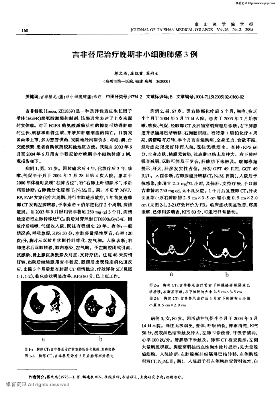 晚期肺鳞癌能治愈吗_吉非替尼能治好晚期肺腺癌吗_肺鳞癌好治还是腺癌好治