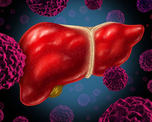 治肝癌晚期偏方_索拉非尼治肝癌晚期能有几个月_肝癌靶向药索拉非尼