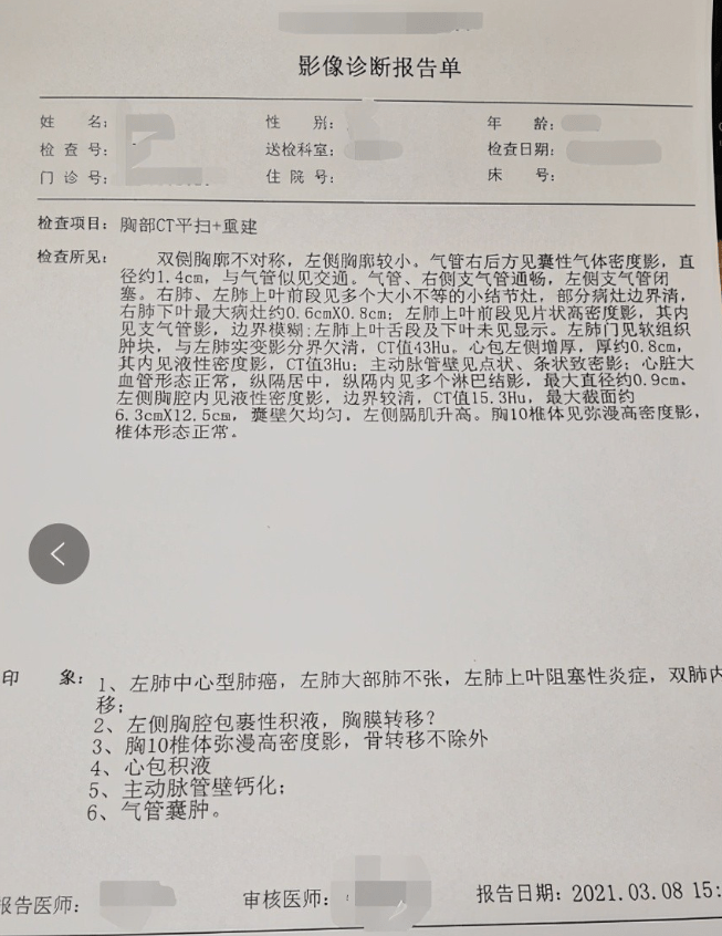 吉非替尼耐药骨转移吃_阿帕替尼多长时间耐药_克唑替尼耐药什么表现?