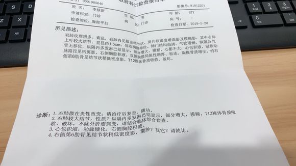 吉非替尼耐药骨转移吃_克唑替尼耐药转让赠药_拉帕替尼多快耐药