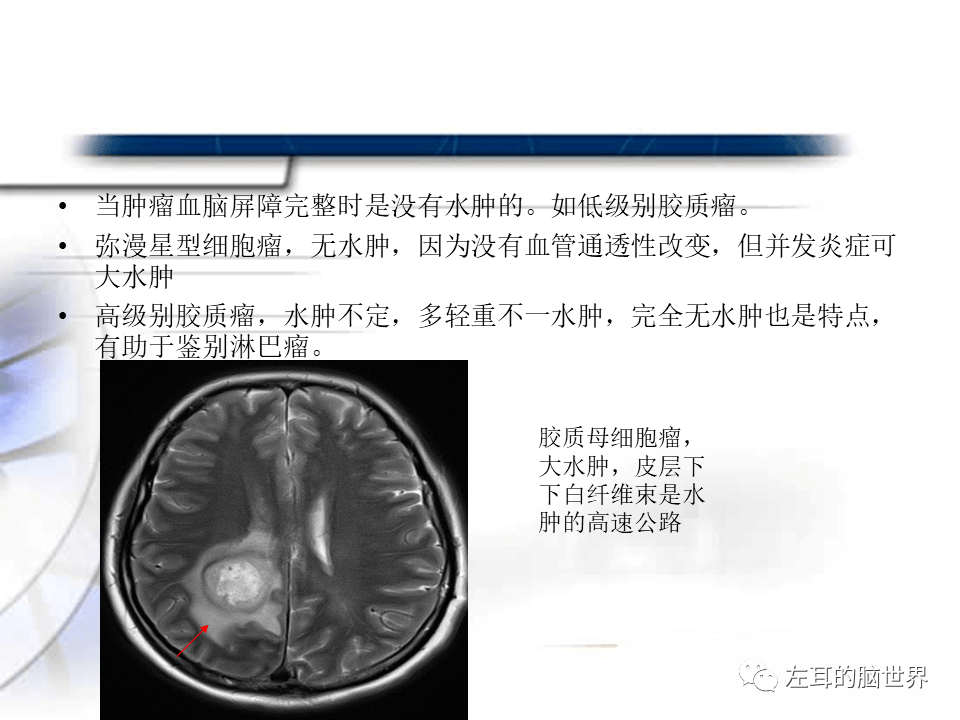 贝伐单抗对恶性脑水肿_贝伐单抗是靶向药吗_西妥昔单抗贝伐单抗