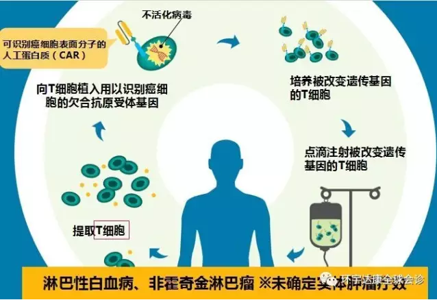 治疗肝癌的索非尼拉_肝癌治疗医院_肝癌中医治疗