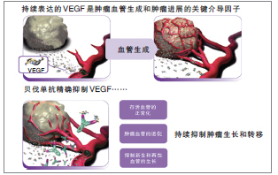 贝伐珠单抗是口服药吗_贝伐珠单抗多少钱一只_贝伐珠单抗的副作用