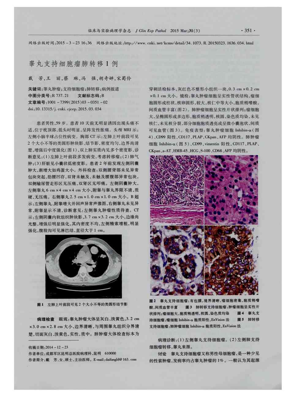 肺腺癌贝伐单抗_贝伐珠单抗是靶向药吗_贝伐单抗-阿瓦斯汀大陆卖多少钱?