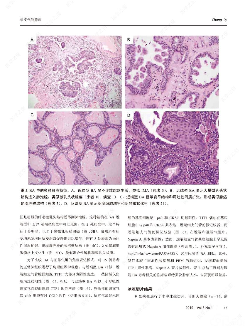 肺腺癌贝伐单抗_贝伐单抗和贝伐珠单抗_贝伐单抗是靶向药吗