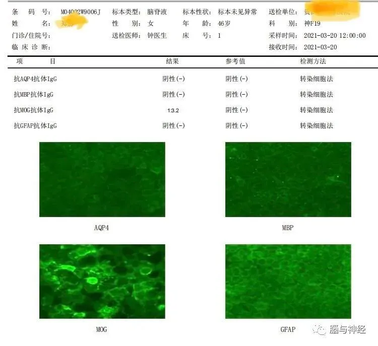 贝伐单抗抗血管脑梗可以用吗_贝伐珠单抗价格_贝伐珠单抗靶向是啥