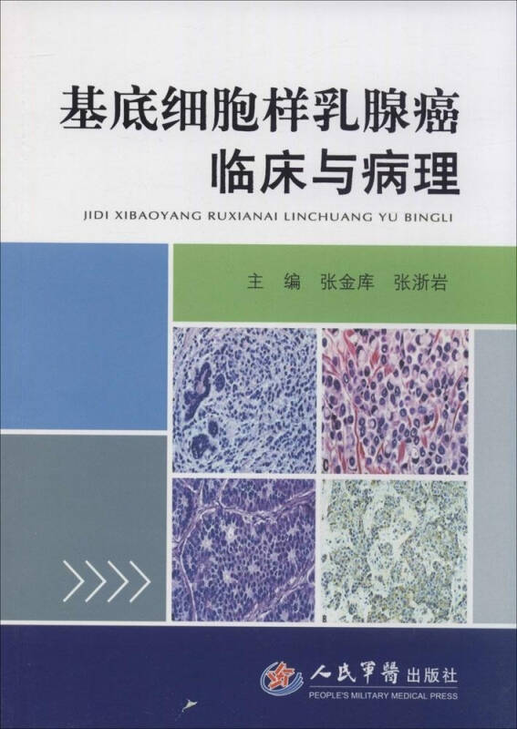 贝伐单抗抗血管脑梗可以用吗_贝伐珠单抗多少钱一支_贝伐珠单抗