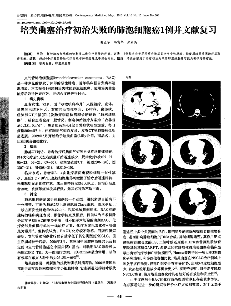 奥希替尼和安罗替尼能交替使用吗_安罗替尼能治疗肝癌吗_azd9291奥希替尼