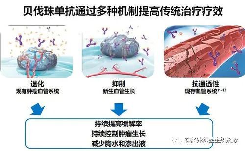 贝伐珠单抗 耐药性_贝伐珠单抗用于低级别胶质瘤_贝伐珠单抗是化疗吗