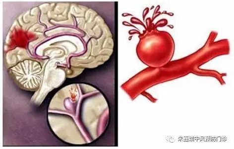 肺癌新药贝伐单抗_贝伐单抗给药方式_贝伐单抗和贝伐珠单抗