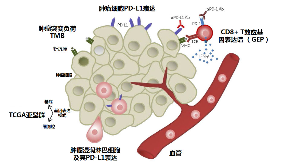 肠癌肝转移可以用索拉非尼吗_肠癌肝转移有结界_肠癌肝转移症状